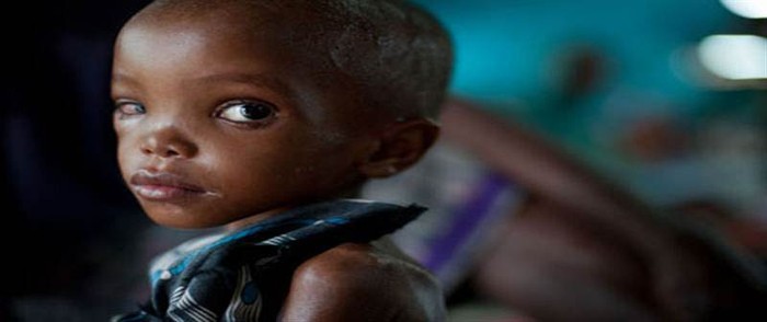 Trẻ em Châu Phi đang phải “chết” lụi từng phút từng giờ. Vì cái đói mà đôi mắt, thân hình của các em đã biến dạng nhiều.